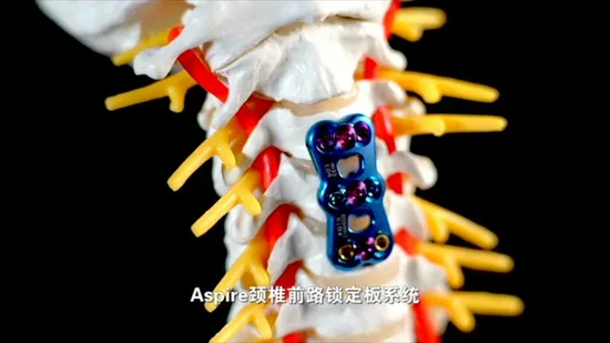 Fissazione cervicale dell'impianto della colonna vertebrale con placca cervicale anteriore